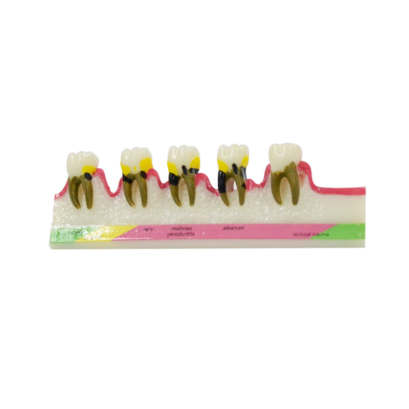 Medical Lab Study - Modelo de Doença Periodontal, Materiais Dentários,