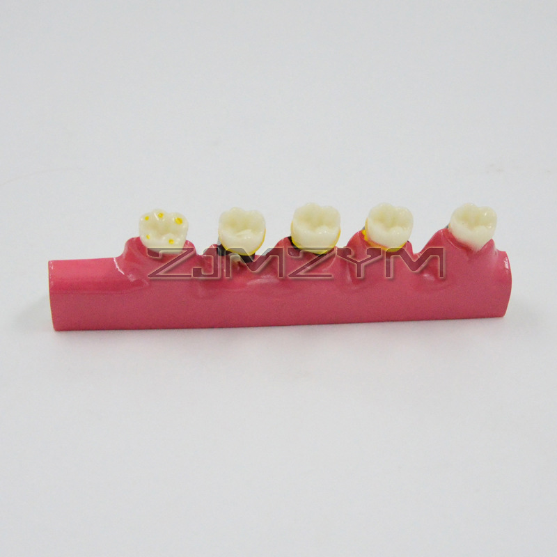 Modelo de Doença Periodontal,  - Medical Lab Study avaliação e preço