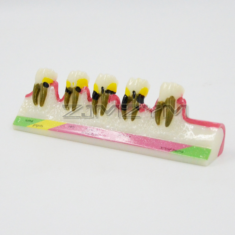 Modelo de Doença Periodontal,  - Medical Lab Study avaliação e preço