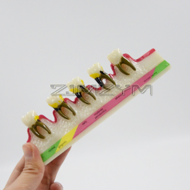 Modelo de Doença Periodontal,  - Medical Lab Study avaliação e preço