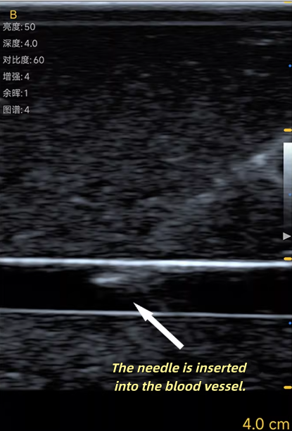Modelo de Treinamento para Pun - Medical Gel Ultrasound avaliação e preço